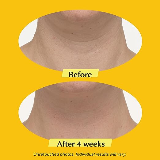 StriVectin TL Advanced Tightening Neck Cream - 3.4oz